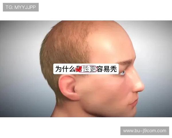 为什么足球运动员很少秃头 解析运动员发量与健康的关系 为什么足球运动员很少秃头 解析运动员发量与健康的关系